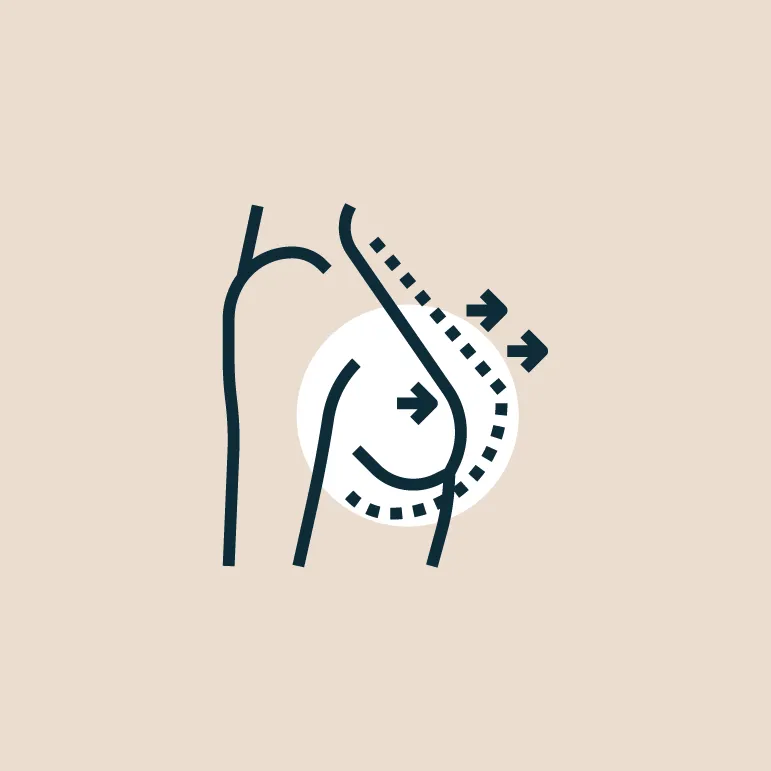 Breast Augmentation