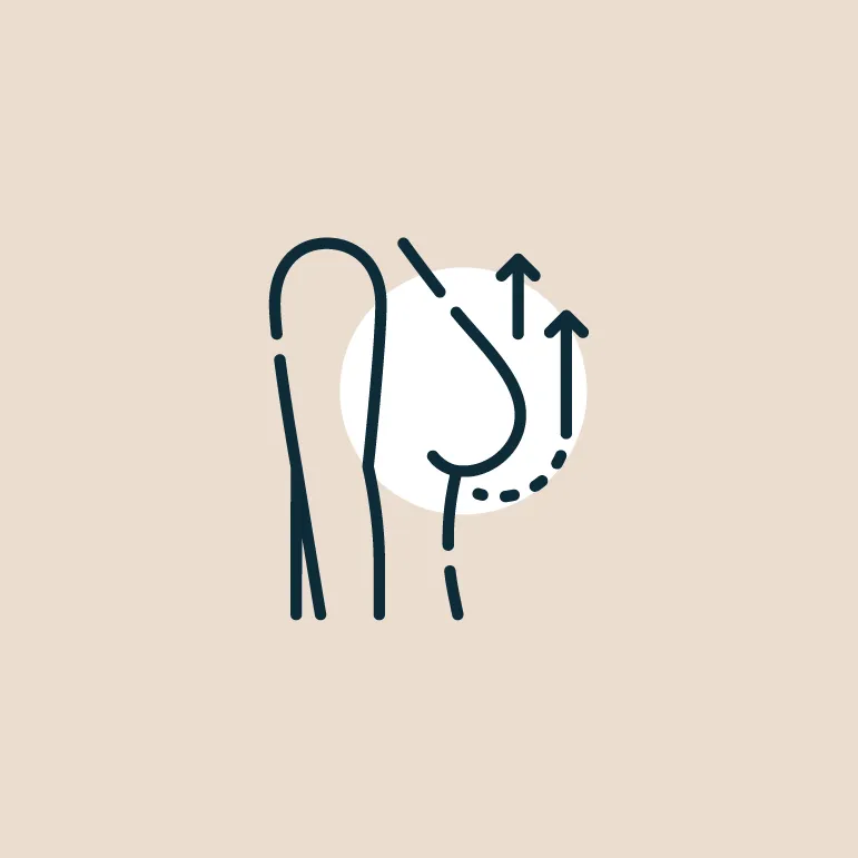 Breast Lift  (Mastopexy)
